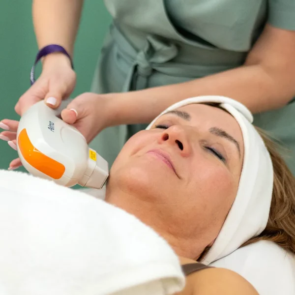 TERMOLIFTING NIR  – laserowe fotoodmładzanie