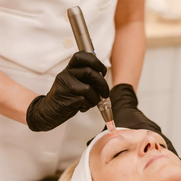 ODA Optimum Derma ® – ZABIEGI Z TECHNOLOGIĄ MIKRONAKŁUWANIA