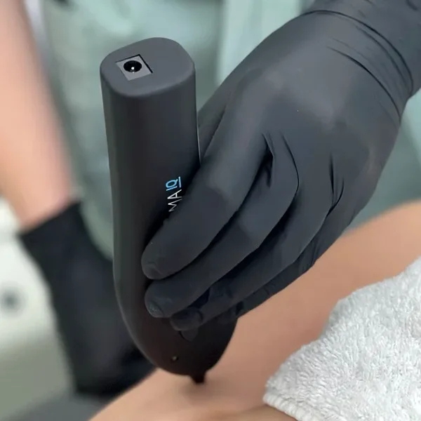 PLASMA IQ usuwanie zmian skórnych